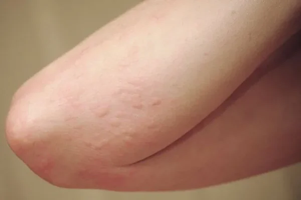 Nông Sản Có Chất Bảo Quản 2